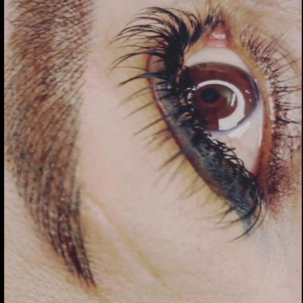 فیبروز روی ابرو